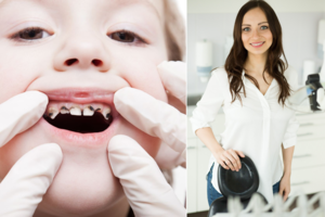 Odontologė: sugedę vaikų pieniniai dantys gali lemti net veido formos pokyčius