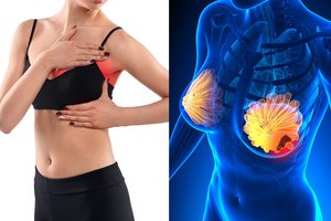 9 pagrindinės krūtų niežulio priežastys: tai gali įspėti net apie vėžį