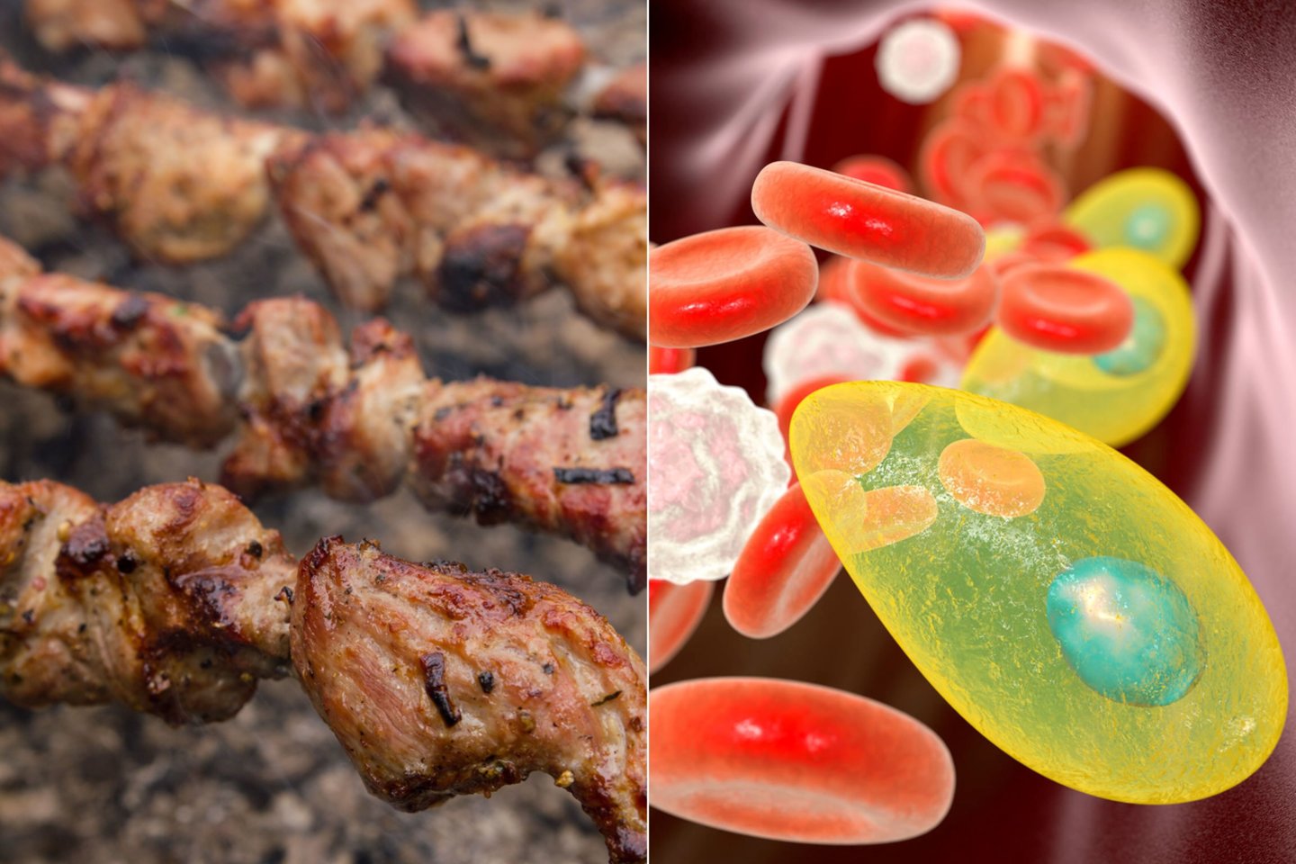 Dauguma žmonių toksoplazmoze užsikrečia valgydami nepakankamai termiškai apdorotą ar žalią mėsą  – šašlykus, ant grotelių keptą mėsą, vytintus mėsos produktus ir kt.<br>123rf nuotr.