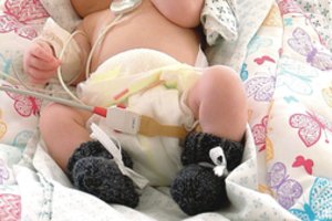 Lietuva jungiasi prie pasaulinės kampanijos neišnešiotiems naujagimiams ir jų šeimoms