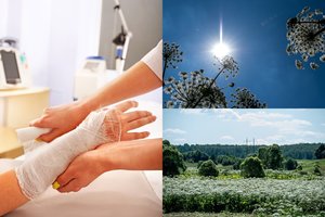 Lietuvoje naikins itin pavojingą augalą: užtryškusios sultys sukelia 1–3 laipsnio nudegimus ir net aklumą