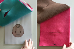 Lyg virusas plintančiame video išaiškino, kaip iš tiesų daroma cezario pjūvio operacija