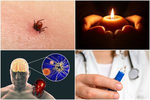 Sergamumas erkiniu encefalitu išaugo beveik trečdaliu: pareikalavo jau dviejų gyvybių