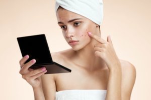 Ekspertė įspėjo dėl aknės: taip ją gydydami tik gilinate problemą