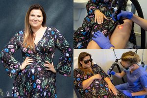 Erika Vitulskienė prabilo apie kančias dėl grožio: „Visos tai daro, bet kažkodėl gėdijasi kalbėti“