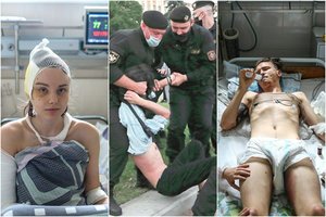 Šiurpios žinios iš ligoninių: po OMON smūgių reanimacijoje atsidūrę žmonės džiaugiasi tik dėl vieno