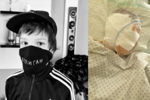 Šuns klaikiai sukandžiotas devynmetis bijo mokyklos: „Kaip aš šitoks ten grįšiu“