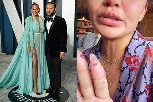 Nėščia Johno Legendo žmona parodė liežuvį: valgo tiek saldumynų, kad šis tuoj nukris