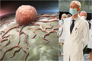 Koronaviruso užnugaryje liko onkologinės ligos: daugėja pacientų su išplitusiu vėžiu 