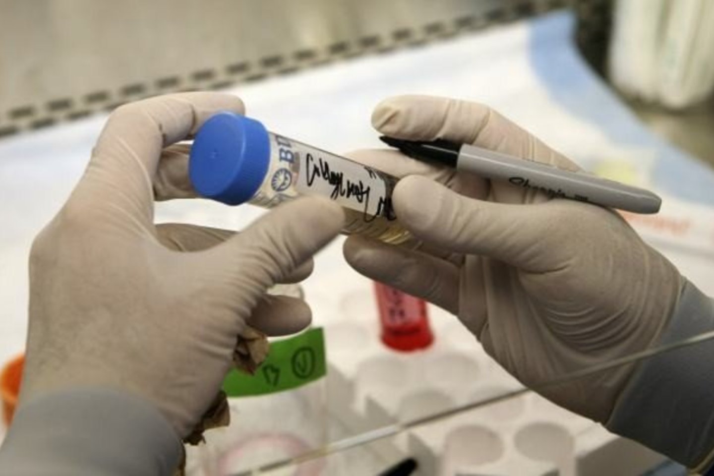 Naujai atrastos imuninės ląstelės gali paskatinti sukurti universalų vėžio gydymą.<br>"Reuters"