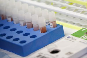 Inovatyvios farmacijos pramonė paneigė kaltininimus dėl vaistų kainos: pasiūlė SAM laikytis nuoseklumo