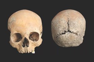 Paauglės kaukolė liudija itin žiaurią bausmę