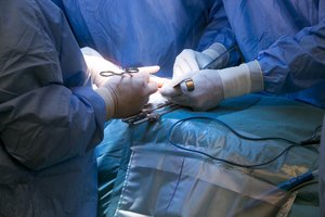 Santaros klinikose – inovatyvūs gydymo metodai: gali padėti išvengti amputacijos