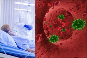 Antrą kartą susirgus COVID-19, sergama lengviau? Jau yra atvejų, kurie tai paneigia