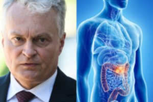 G. Nausėdai išoperavus žarnyno polipą, medikai priminė, ką būtina žinoti 