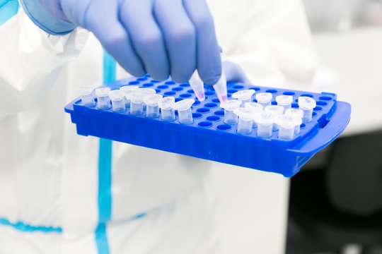Laboratorija įspėja: gali pritrūkti mėgintuvėlių koronaviruso tyrimams
