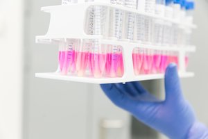 A. Veryga ramina įsiplieskusias aistras: mėgintuvėlių laboratorijai nepritrūks