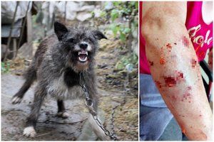 Rokiškio r. nuo grandinės nutrūkęs šuo dantis suleido į moters ranką