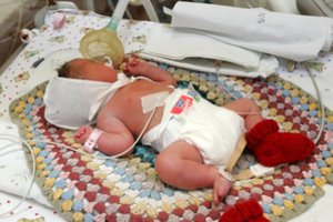 Lietuvoje kasmet gimsta apie 2 tūkst. neišnešiotukų: šią statistiką įvertino pasauliniu mastu 