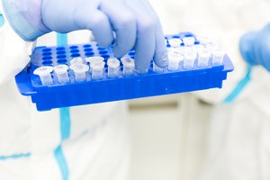 Privačioms laboratorijoms už koronaviruso tyrimus valstybė sumokėjo beveik 7 mln. eurų