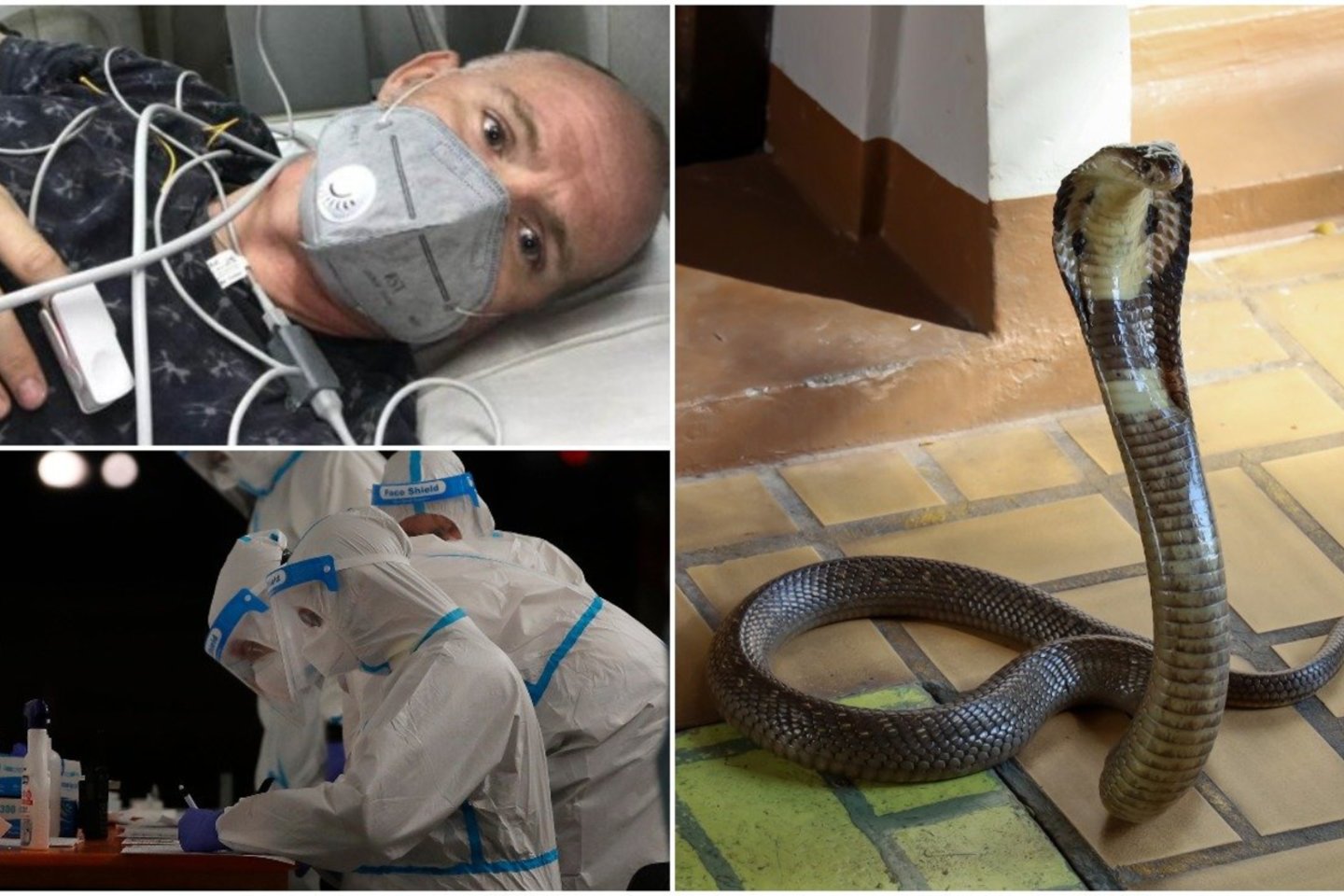  Vyras išgyveno koronaviruso infekciją, dengė ir maliariją, o tuomet jam Indijos Radžastano valstijoje įkando potencialiai mirtina kobra.<br> lrytas.lt koliažas.