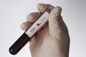 Rytų Europoje ir Centrinėje Azijoje daugėja nediagnozuotų užsikrėtimo ŽIV atvejų