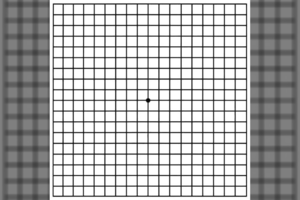 Paprastas akių testas atskleis, ar jums negresia rimta akių liga