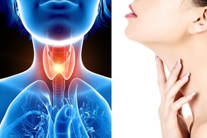 Skydliaukė – mažas, bet labai svarbus organas, simptomai apie jos negalavimus būna apgaulingi