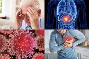 Atnaujintas daugiausiai žmonių gyvybių pareikalavusių ligų dešimtukas: įtraukė Alzheimerį ir diabetą, koronavirusas – nepateko