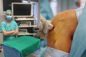 Atliko pirmą tokią operaciją Lietuvoje: žada greitesnį gijimą po sportuojančius ištinkančios traumos