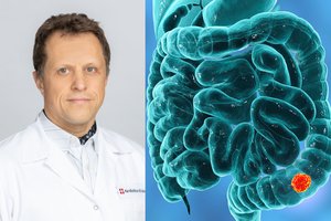 Gydytojas: šį susirgimą žmonės linkę ignoruoti, o jo simptomai gali slėpti pavojingą ligą