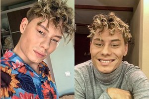 Katytėmis gerbėjas vadinantis stilistas Ąžuolas atvėrė širdį apie klausos sutrikimą ir plastines operacijas