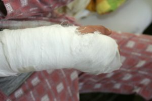 Medikai perspėjo: dėl tokio žmonių elgesio netrukus gali padaugėti sunkių traumų