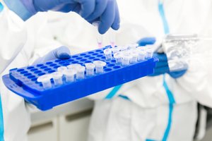 Australijos mokslininkai: persirgus COVID-19 imunitetas išlieka mažiausiai 8 mėnesius