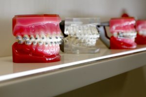Pacientų ilgai laukta žinia: nebelieka dantų protezavimo eilių