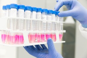 Visos koronaviruso statistikos pateikti negalėjęs NVSC aiškinasi, kas įvyko: pirštu rodo ir į laboratorijas 