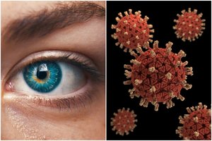 Tyrimas atskleidė, kaip koronavirusas paveikia akis