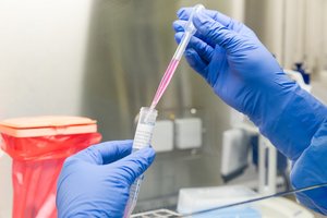 Ekonomikos temperatūra krito: kuo ilgiau užtruks kova su virusu, tuo gilesni randai liks