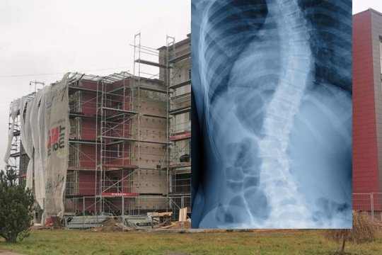 Renovacija nepatenkintą plungiškį rangovas auklėjo kumščiais – žmogui sulaužė šonkaulį