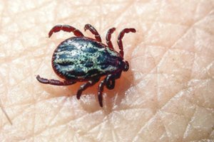 Nuo erkinio encefalito skiepytis rekomenduojama pradėti žiemą