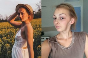 Siaubingus išgyvenimus patyrusi 21 m. kaunietė: „Tikėjausi stebuklo, ir jis įvyko“