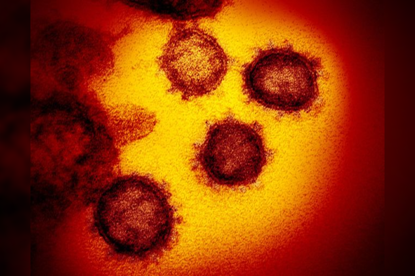  SARS-CoV-2 ant žmogaus ląsteliu paviršiaus (realus vaizdas).<br>  NIAID-RML nuotr.