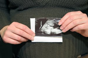 Nėštumas ir pirmieji vaiko priežiūros metai: kokios socialinės garantijos priklauso tėvams