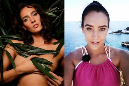 „Dydžio revoliucijos“ nugalėtoja Vitalija Jonikytė atsidūrė ligoninėje: atliko sudėtingą operaciją