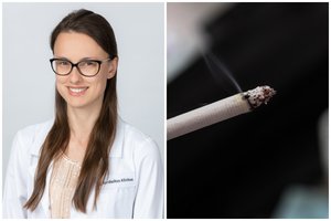 Gydytoja oftalmologė išvardijo 7 priežastis, kodėl verta mesti rūkyti