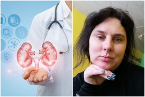 Inkstą dovanų gavusi jauna jurbarkietė: „Išgelbėjo ne tik mane, bet ir mano vaikus“