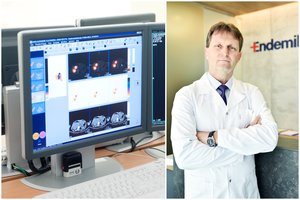 Klastinga liga kasmet nusineša šimtus moterų gyvybių: gydytojas nurodė, ko būtina imtis