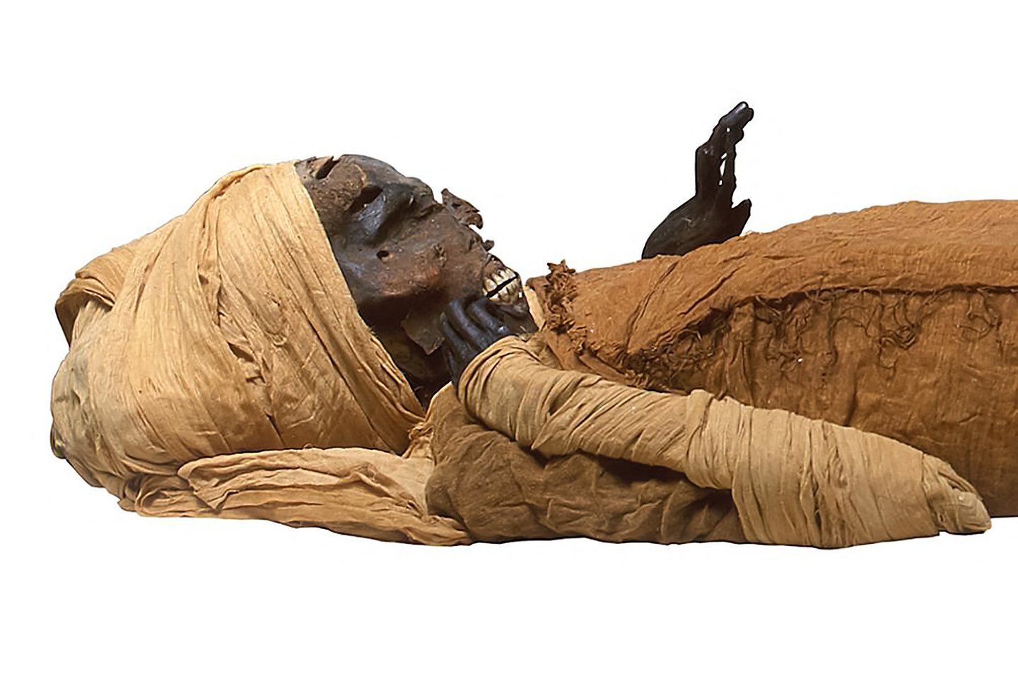  Kaulų skenavimas taip pat atskleidė, kad faraonui buvo apie 40 metų, kai jis mirė.<br> AFP / Scanpix nuotr.