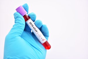 JAV prezidento patarėjas pandemijos klausimais įspėjo, kada šalis grįš į normalų gyvenimą