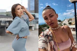 Eglė Jakštytė atvėrė širdį apie tai, kaip jaučiasi po krūtinės operacijos: „Laukiau per ilgai“